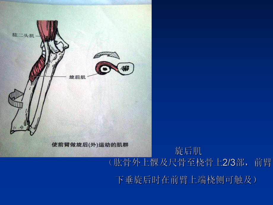 肱骨外上髁炎-医学课件.ppt_第3页