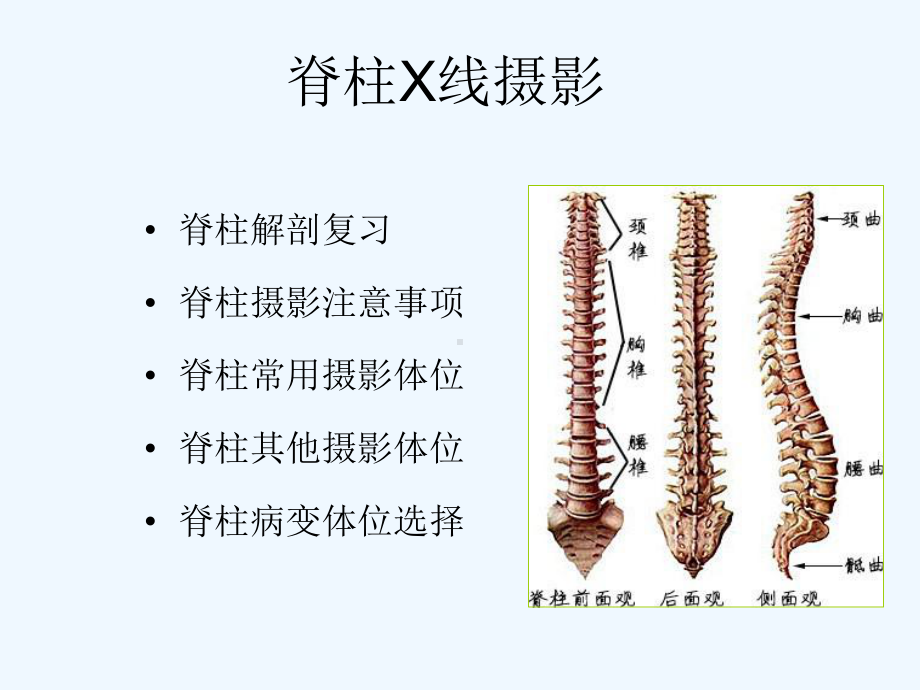 脊柱X线摄影技术演示文稿课件.ppt_第2页