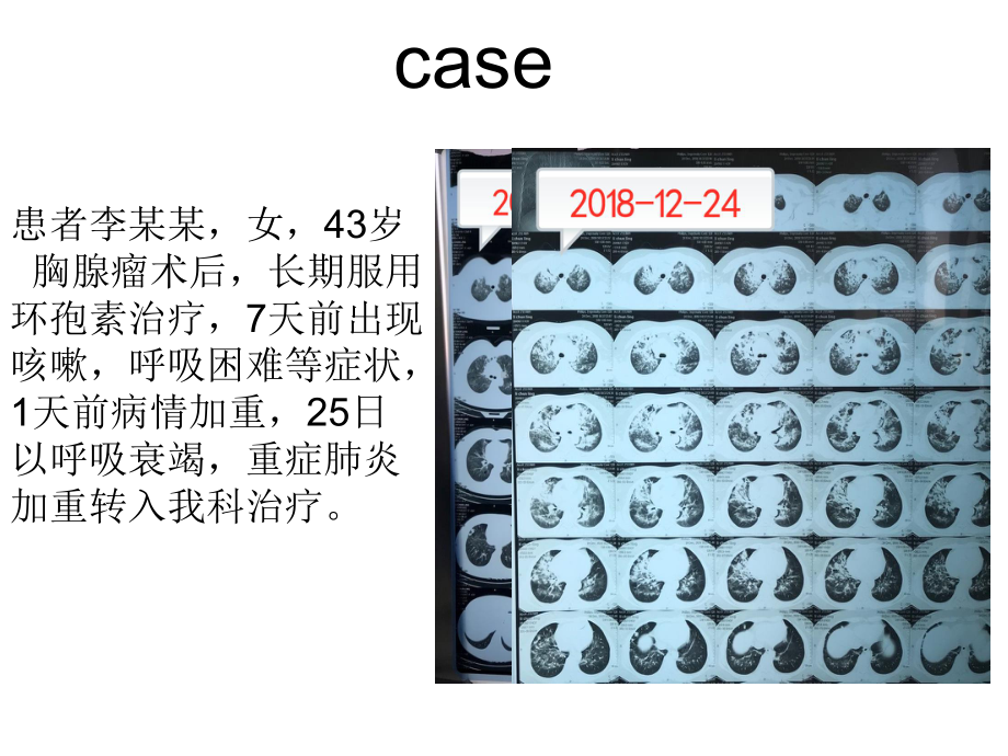 经鼻高流量氧疗的临床应用课件.pptx_第2页