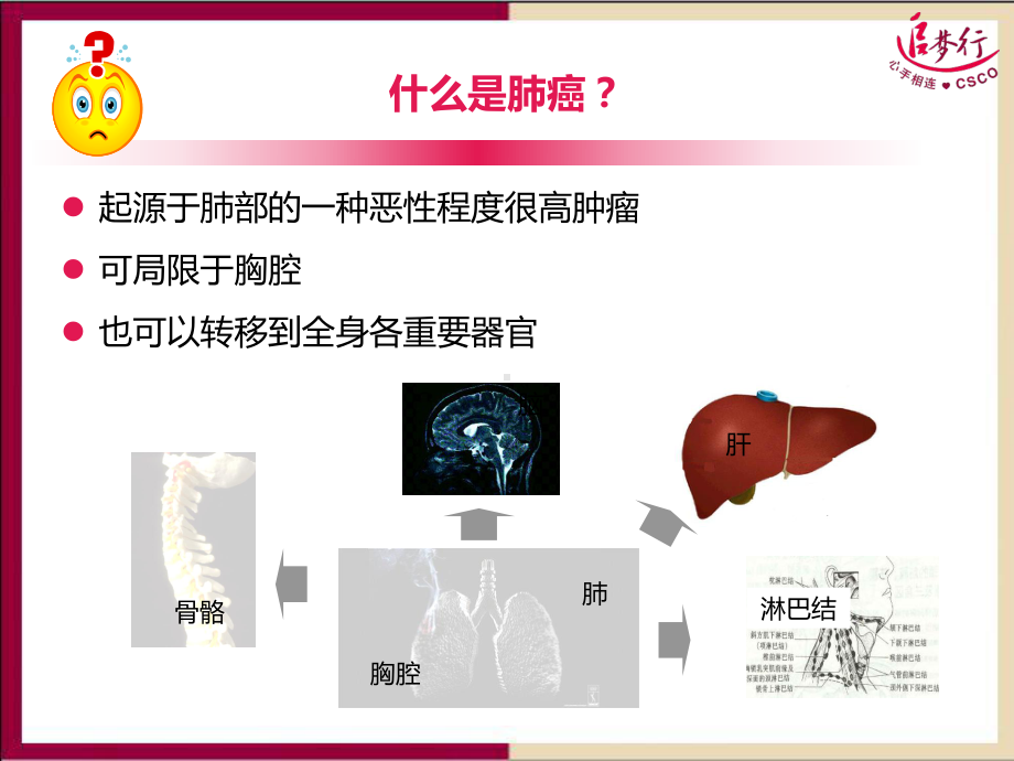 肺癌基础知识PPT课件.ppt_第2页