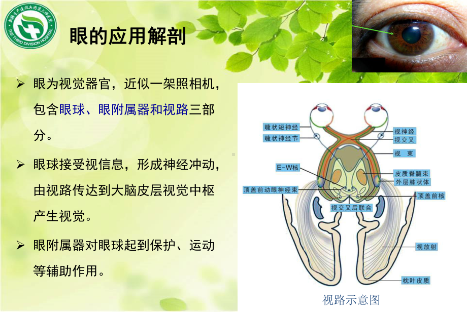 眼外伤的应急救护PPT课件.ppt_第3页