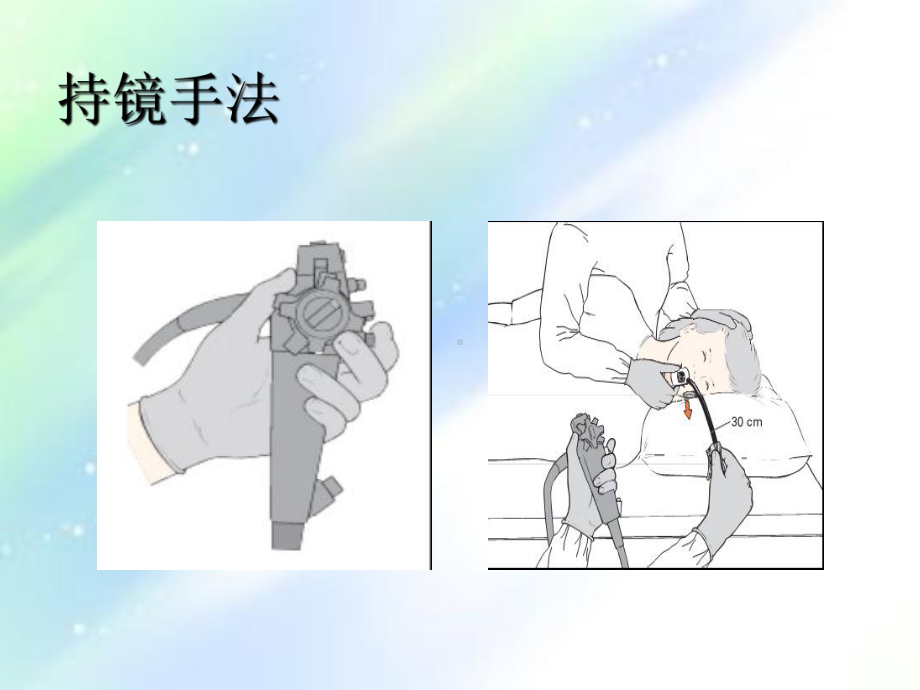 胃镜操作规范ppt课件.ppt_第3页