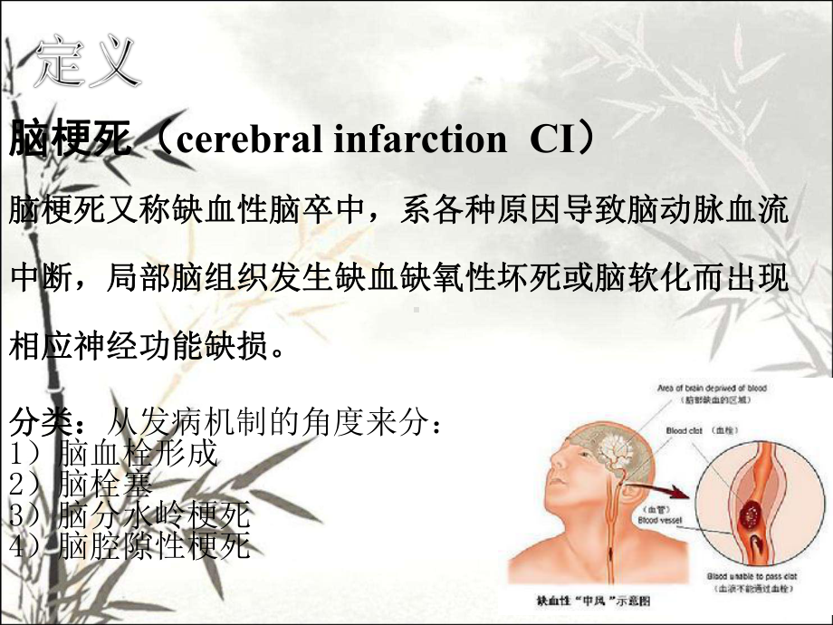 脑梗死的护理课件PPT.ppt_第2页