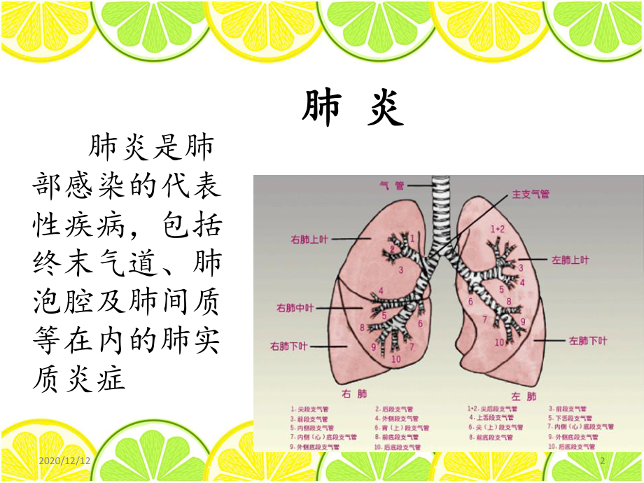 肺部感染-ppt课件.ppt_第2页