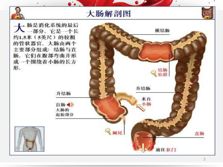 直肠癌术后的护理-ppt课件.ppt_第3页