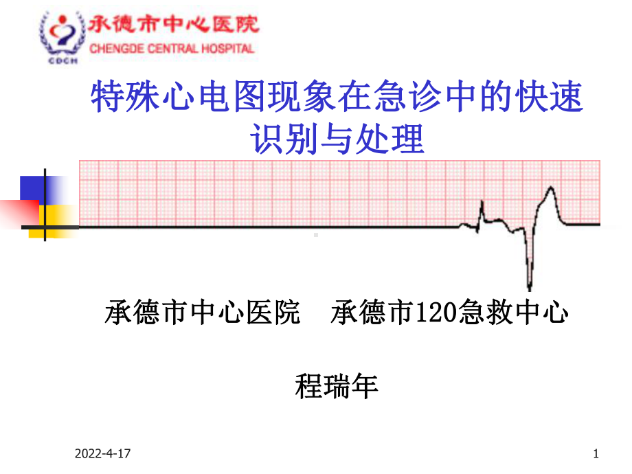 特殊心电图现象在急诊中的快速识别与处理课件.pptx_第1页