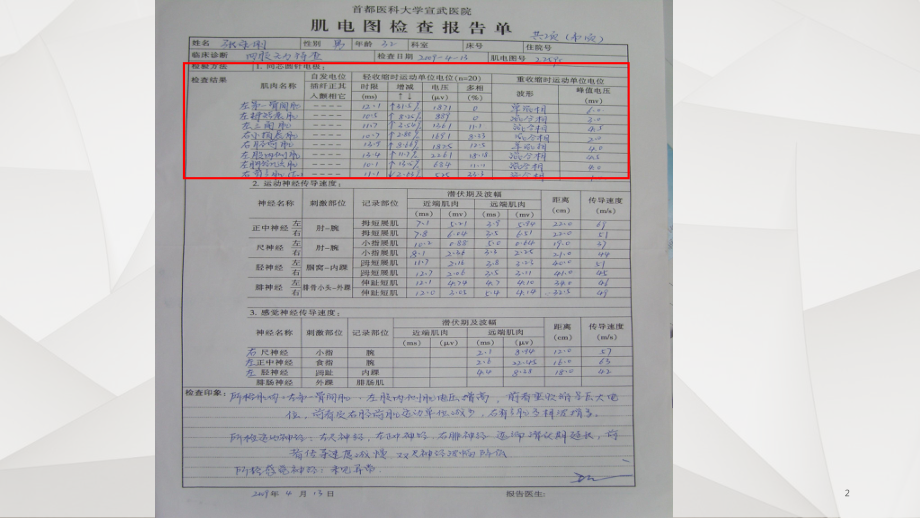 肌电图的判读课件.ppt_第2页