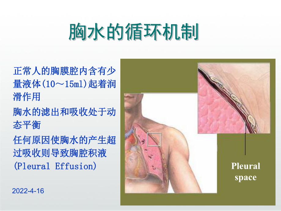 胸腔积液ppt课件.ppt_第3页