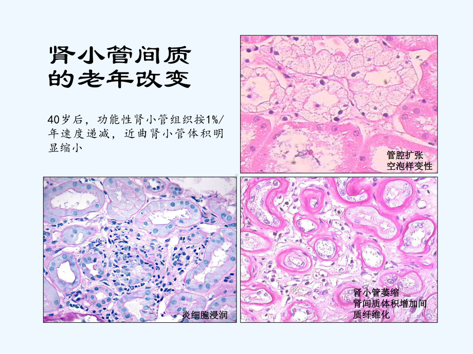 老年肾功能与用药(ppt)课件.ppt_第3页