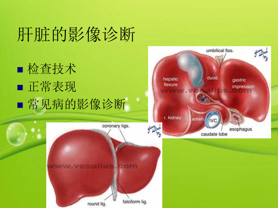 肝胆胰脾影像表现-PPT课件.ppt_第2页