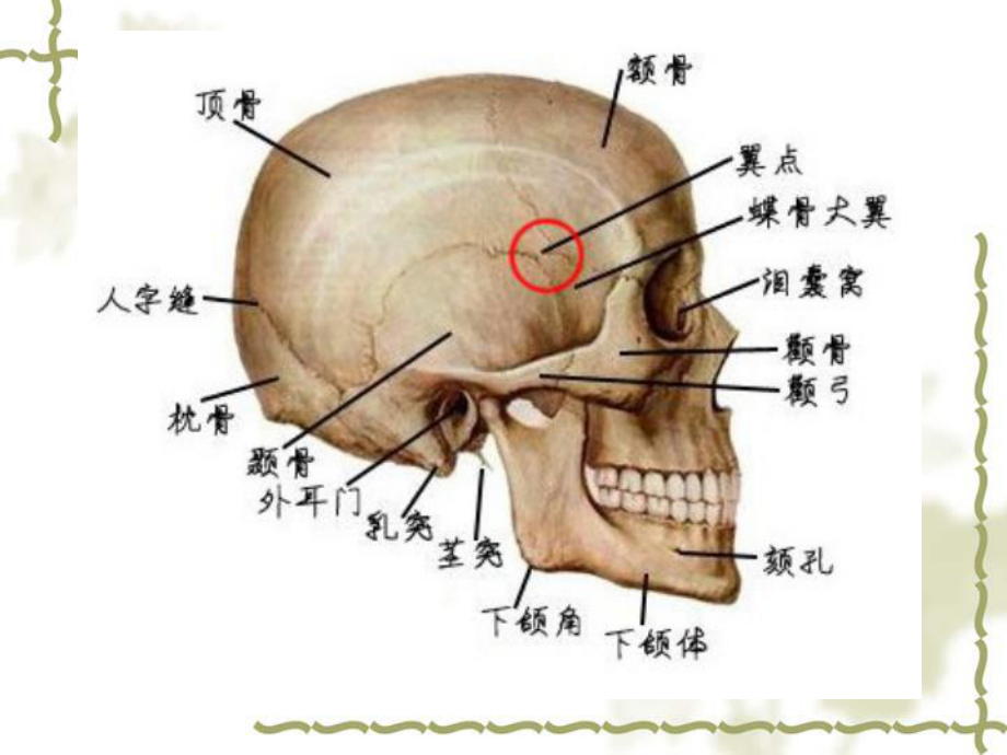 硬脑膜外血肿课件.pptx_第3页