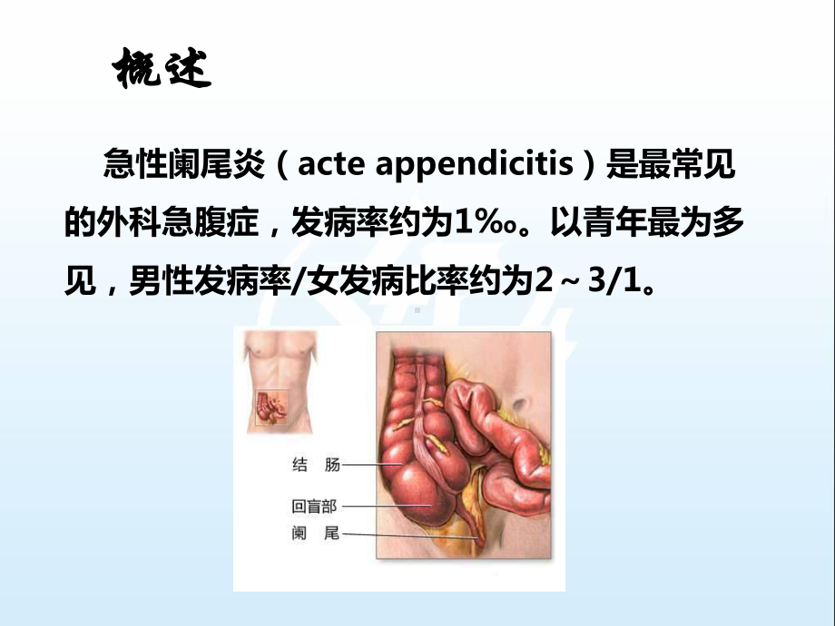 第三节急性阑尾炎病人的护理-外科护理课件.ppt_第3页