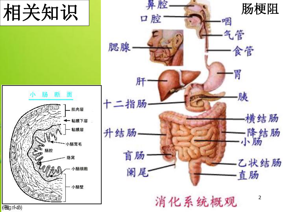 肠梗阻病人的护理-PPT课件.ppt_第2页