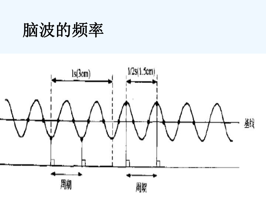 脑电图基本入门演示文稿课件.ppt_第3页