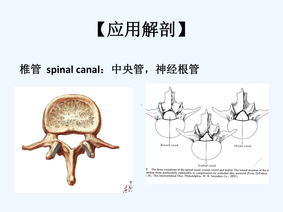 腰椎间盘突出症(A)[可修改版ppt]课件.ppt_第2页