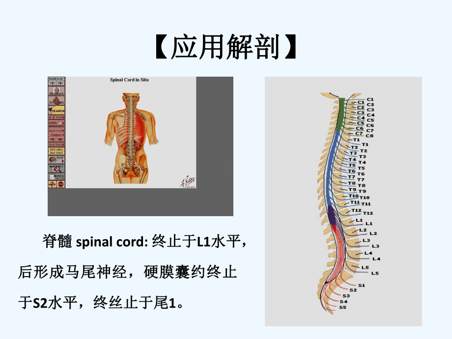 腰椎间盘突出症(A)[可修改版ppt]课件.ppt_第3页