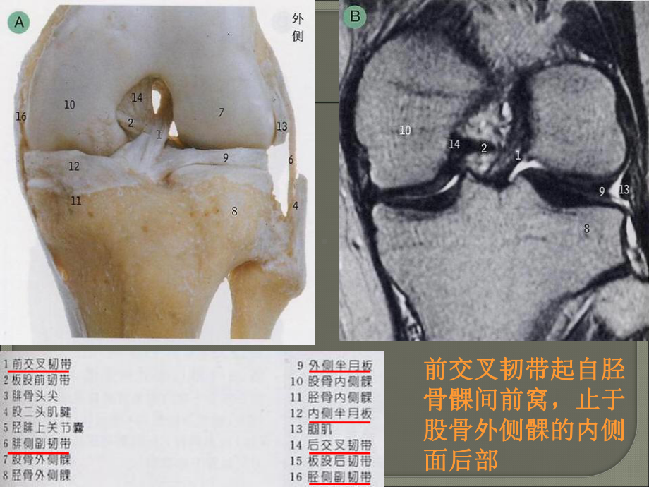 膝关节解剖MR解读及常见病变MR诊断课件.ppt_第3页