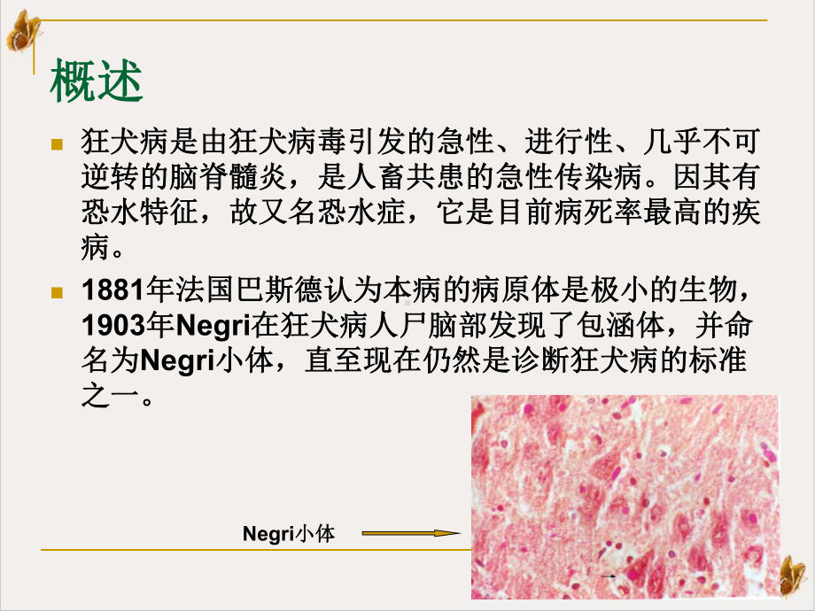 狂犬病讲课稿课件PPT.pptx_第2页