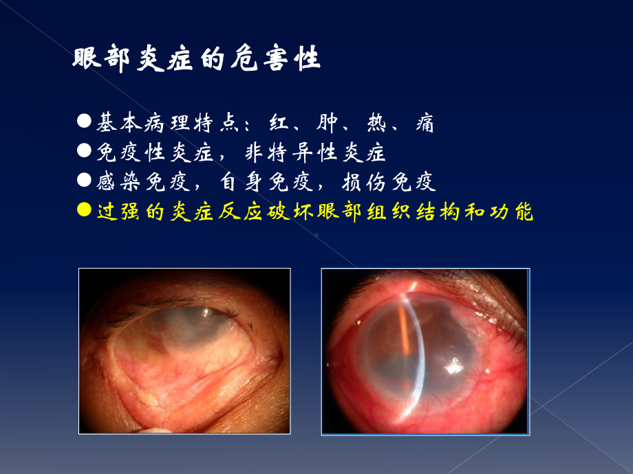 激素在眼表疾病中的使用原则与策略PPT课件.pptx_第3页