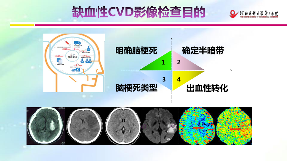 脑卒中的影像诊断治疗-PPT课件.ppt_第2页