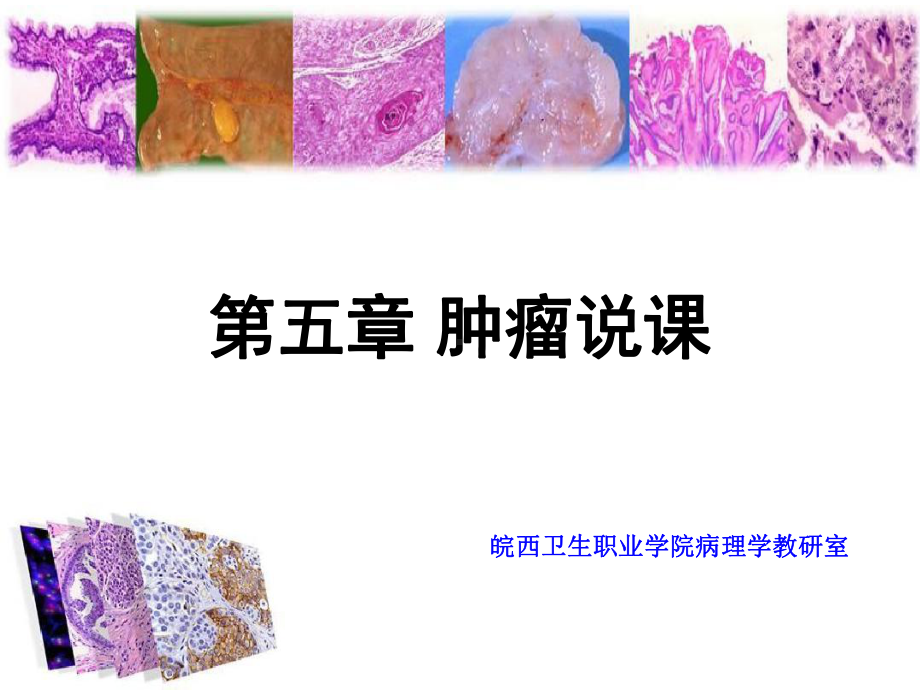 肿瘤说课ppt课件.ppt_第1页