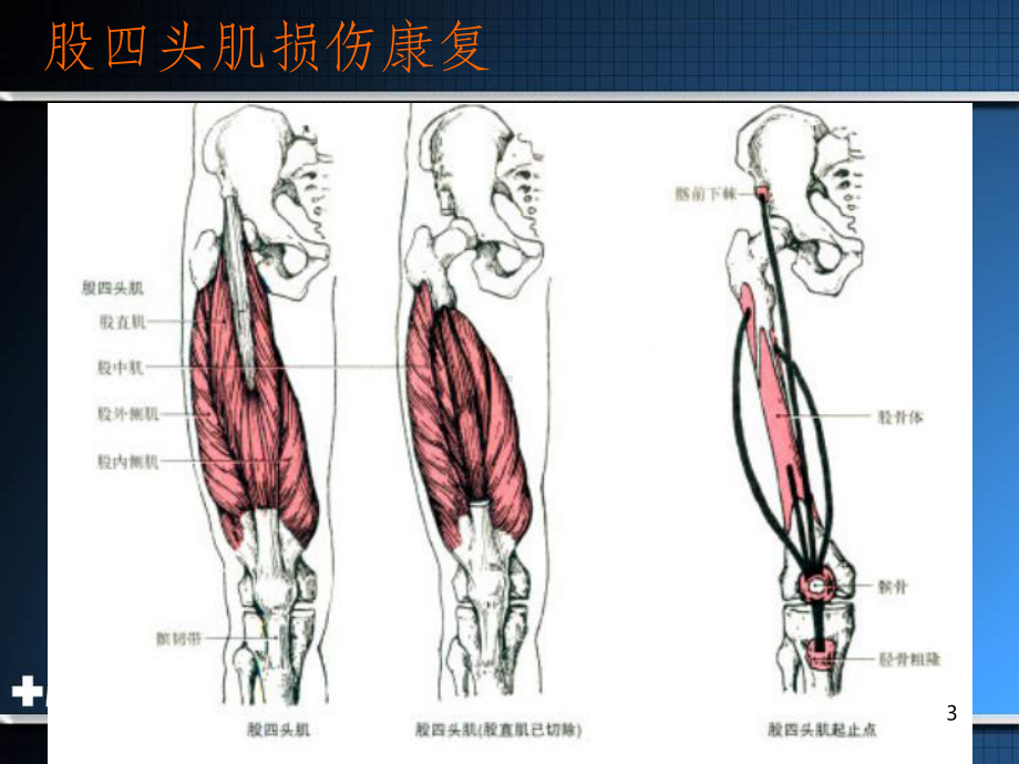 肌肉肌腱损伤康复PPT课件.ppt_第3页