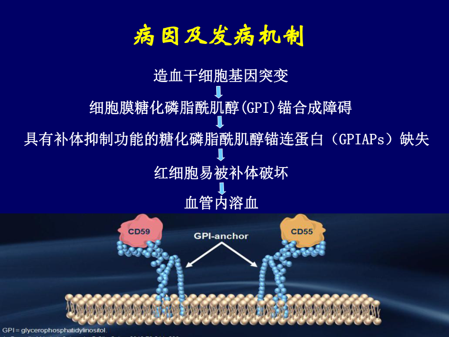 阵发性睡眠性血红蛋白尿.ppt_第3页