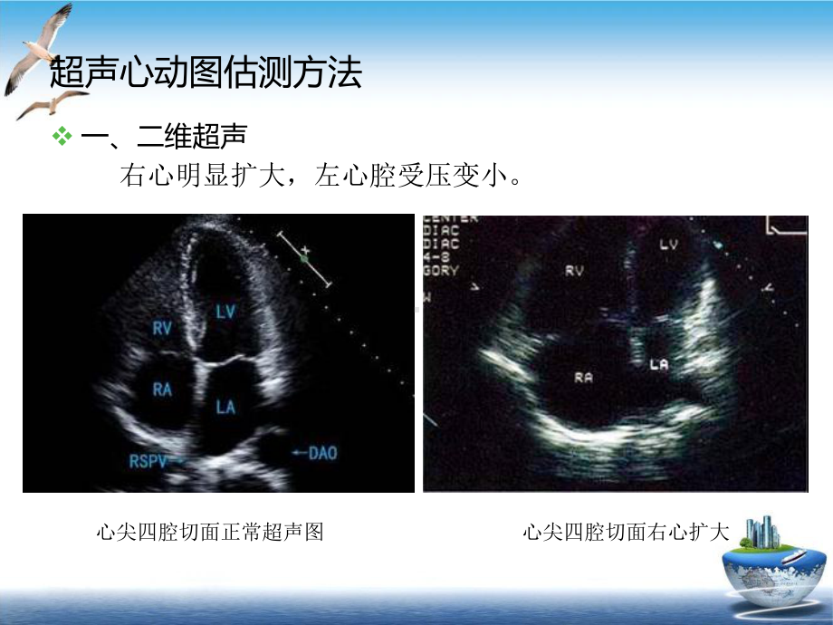 肺动脉高压的超声估测量方法参考课件.ppt_第3页