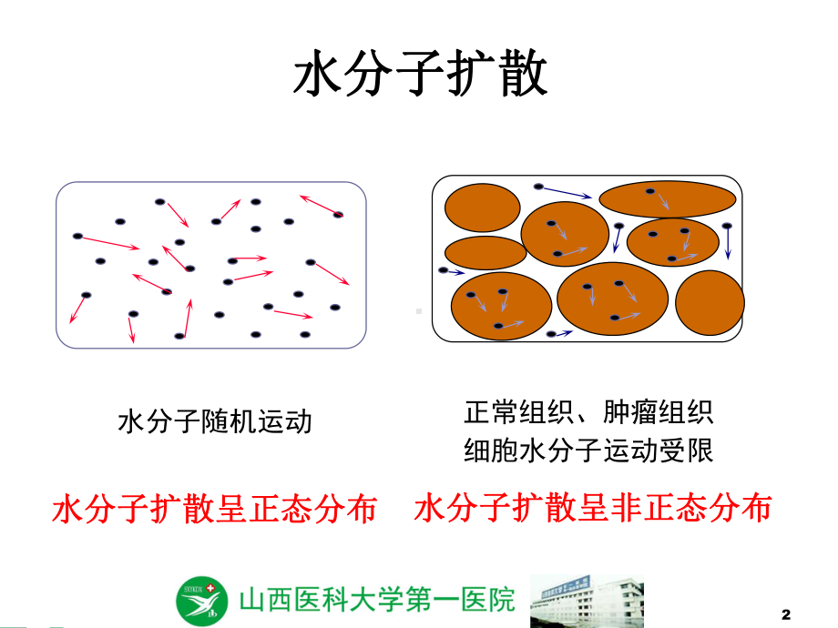 磁共振扩散峰度成像在脑肿瘤的研究进展课件.ppt_第2页