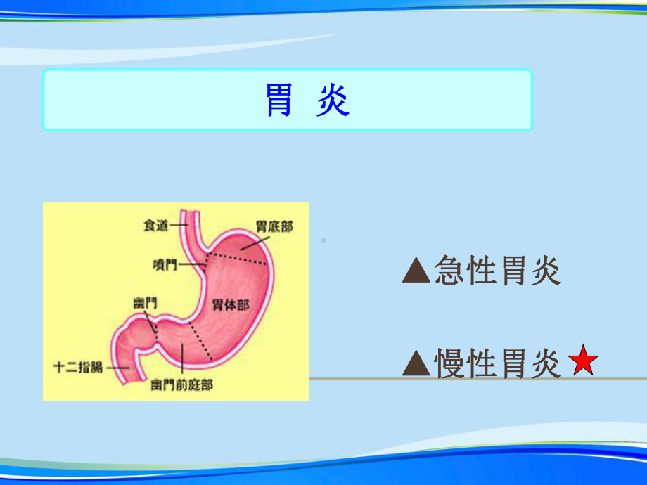 慢性胃炎护理查房.完整版PPT资料课件.ppt_第2页