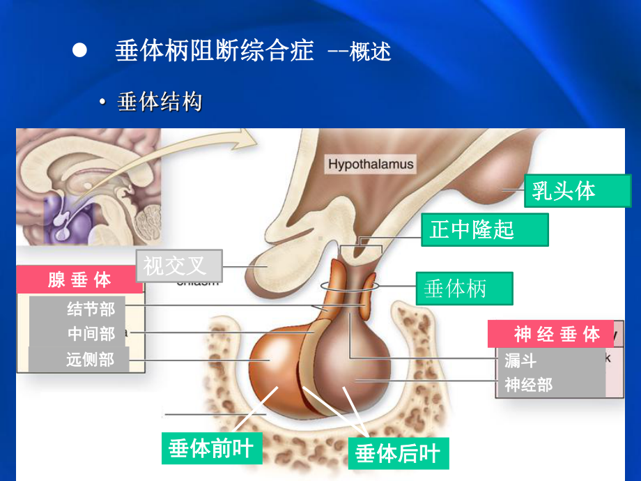 垂体柄阻断综合症PPT优质课件.pptx_第3页