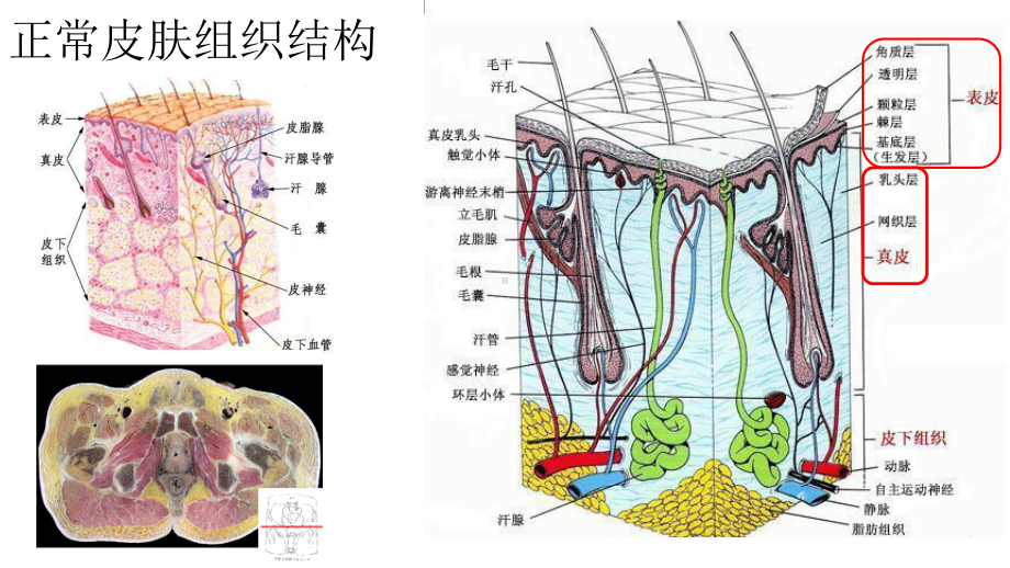 压力性损伤新版本课件.ppt_第2页