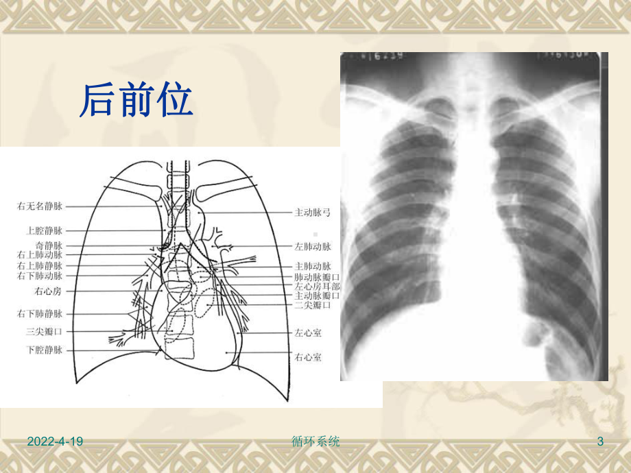 循环系统心脏大血管的正常X线表现课件.pptx_第3页