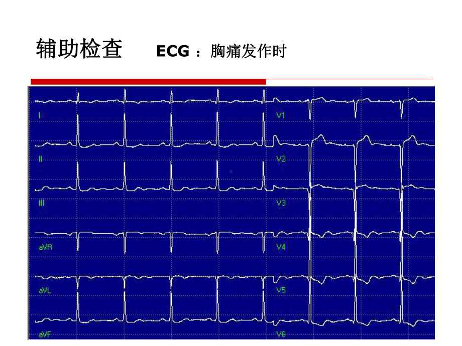 急慢心包积液的处理策略课件.ppt_第3页