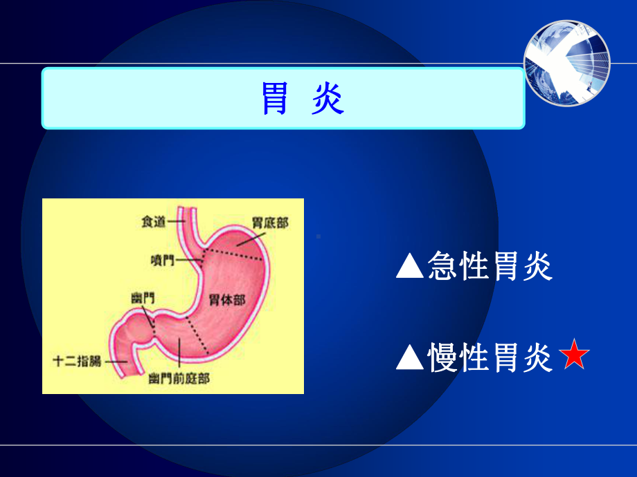 慢性胃炎护理查房-(精品)课件.ppt_第2页