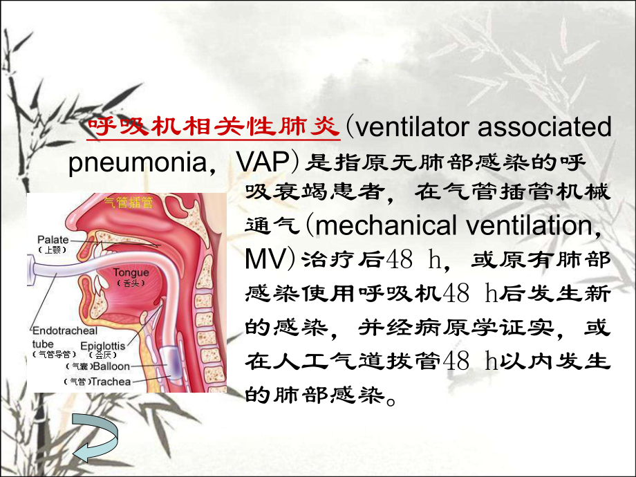 呼吸机相关性肺炎的预防及护理-PPT课件.ppt_第2页