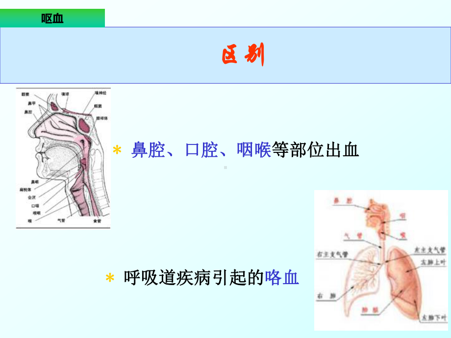 呕血咯血便血PPT课件.ppt_第3页