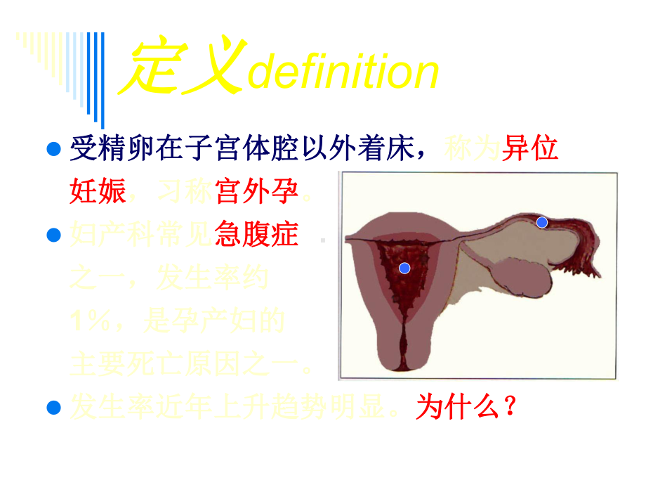 异位妊娠专业知识讲座PPT培训课件.ppt_第3页