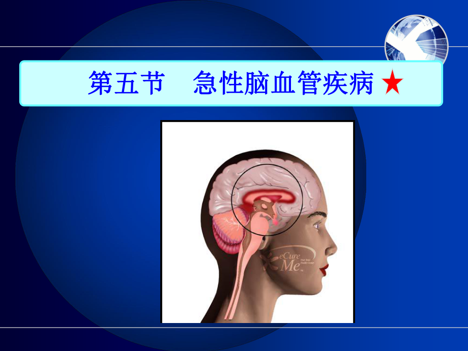 急性脑血管疾病病人的护理课件.ppt_第2页