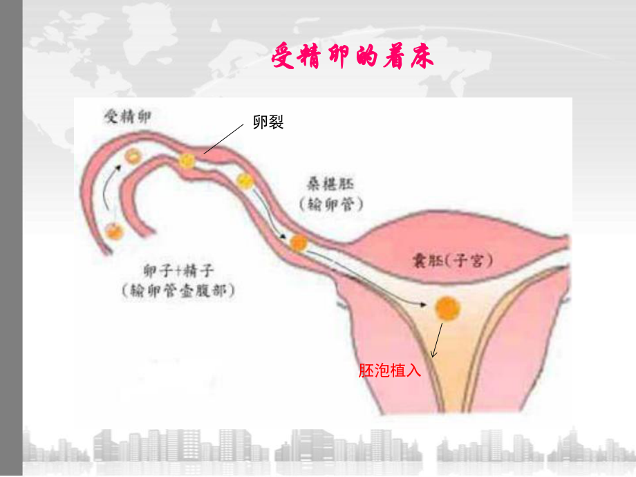 异位妊娠教学查房最新课件.pptx_第3页