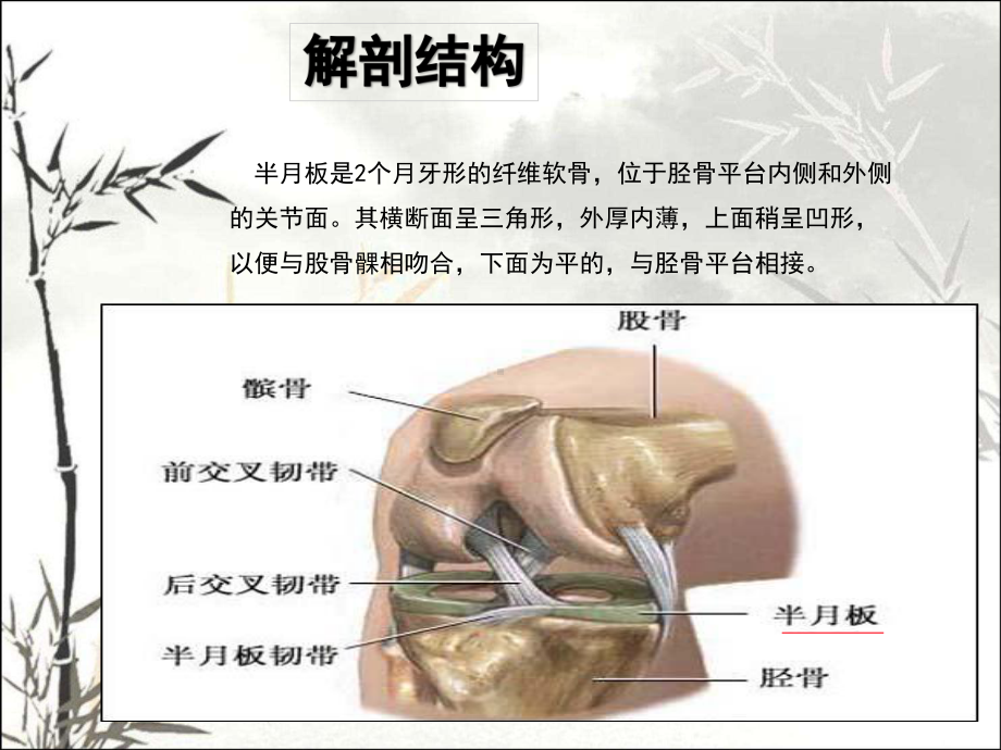 半月板损伤护理ppt课件.ppt_第3页