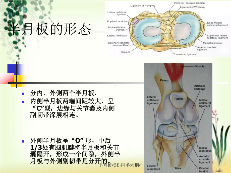 半月板损伤围手术期护理课件.ppt_第2页