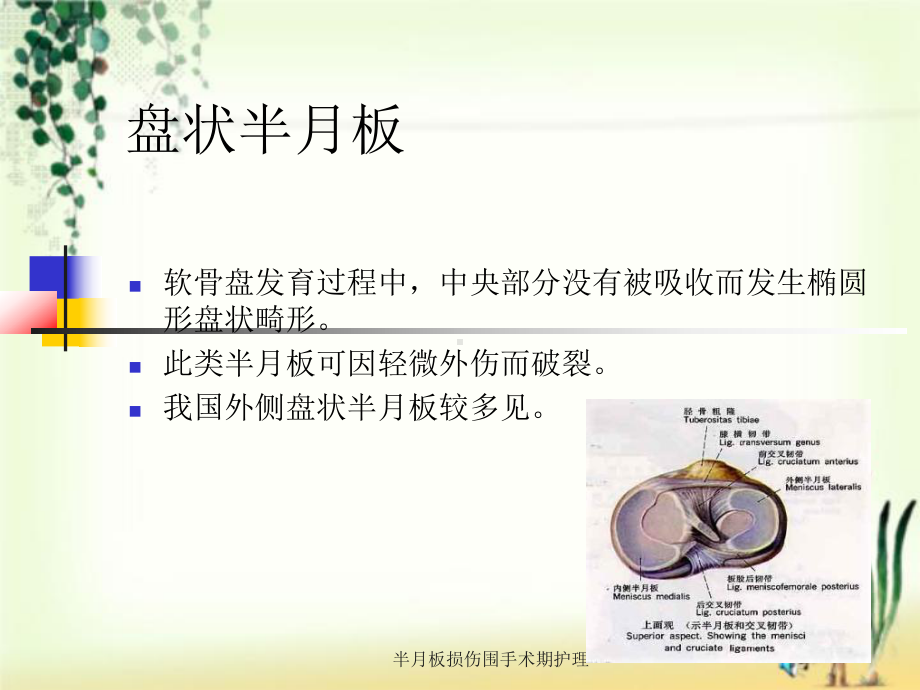 半月板损伤围手术期护理课件.ppt_第3页