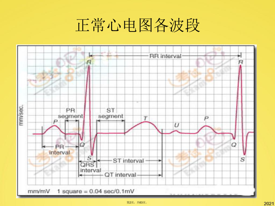 常见病心电图表现(共63张PPT)课件.pptx_第2页