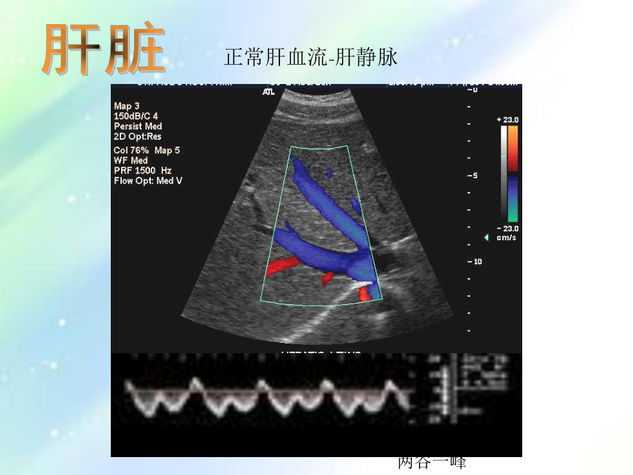 常见病B超图谱-PPT课件.ppt_第3页