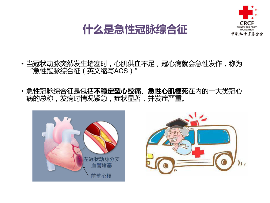 最新急性冠脉综合征患者教育主题讲座课件.ppt_第2页