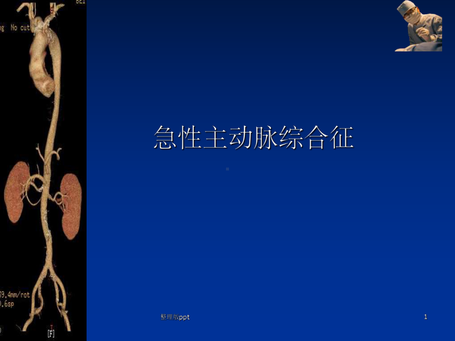 急性主动脉综合征课件.ppt_第1页