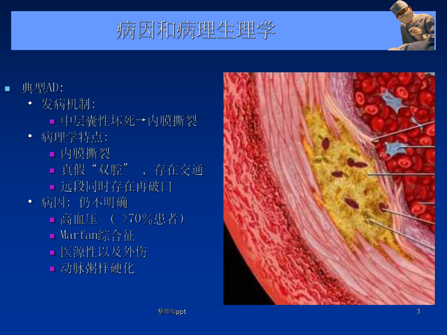 急性主动脉综合征课件.ppt_第3页