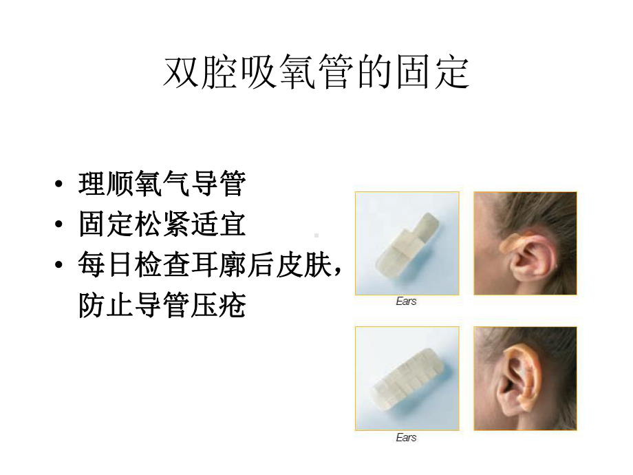 各种导管固定PPT课件.ppt_第3页