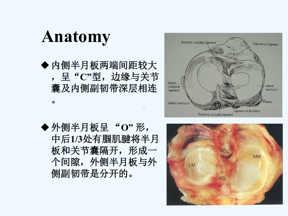 半月板损伤的诊断与治疗幻灯片课件.ppt_第2页